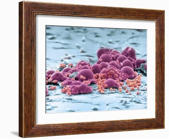 Fat Cells, SEM-Science Photo Library-Framed Photographic Print