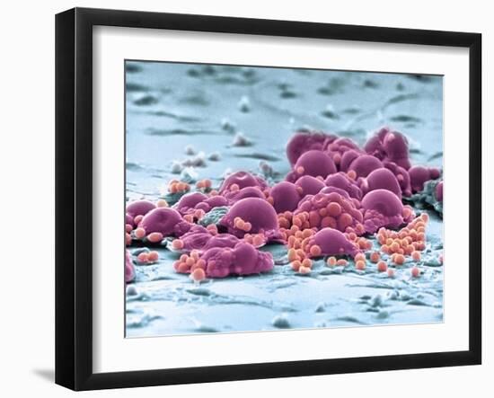 Fat Cells, SEM-Science Photo Library-Framed Photographic Print
