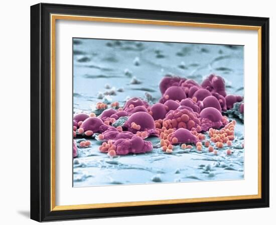 Fat Cells, SEM-Science Photo Library-Framed Photographic Print