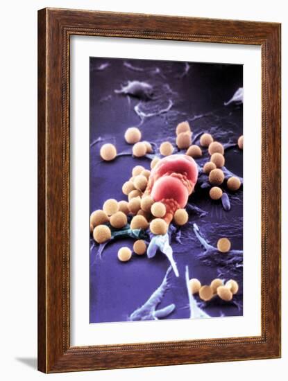 Fat Cells, SEM-Science Photo Library-Framed Photographic Print