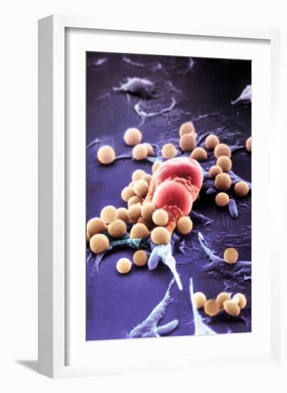 Fat Cells, SEM-Science Photo Library-Framed Photographic Print