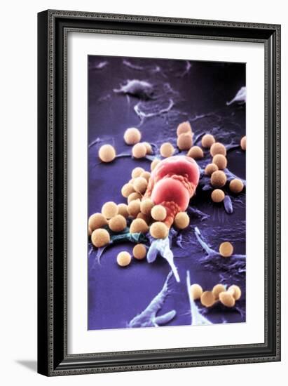 Fat Cells, SEM-Science Photo Library-Framed Photographic Print