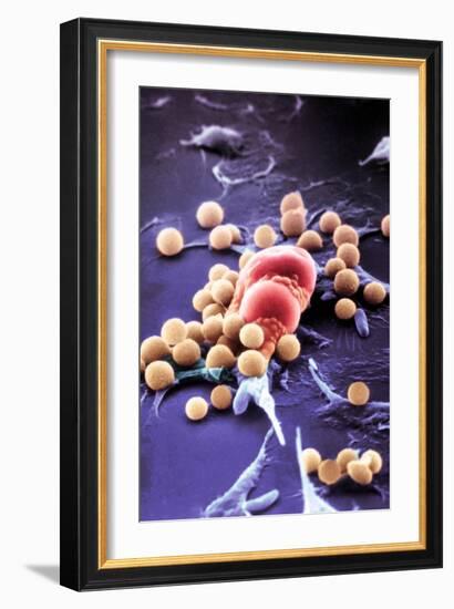 Fat Cells, SEM-Science Photo Library-Framed Photographic Print