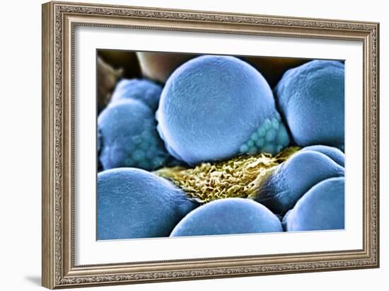 Fat Cells, SEM-Science Photo Library-Framed Photographic Print