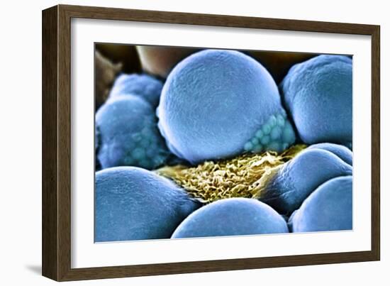 Fat Cells, SEM-Science Photo Library-Framed Photographic Print