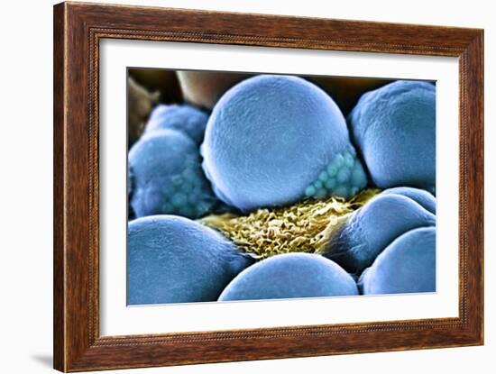 Fat Cells, SEM-Science Photo Library-Framed Photographic Print