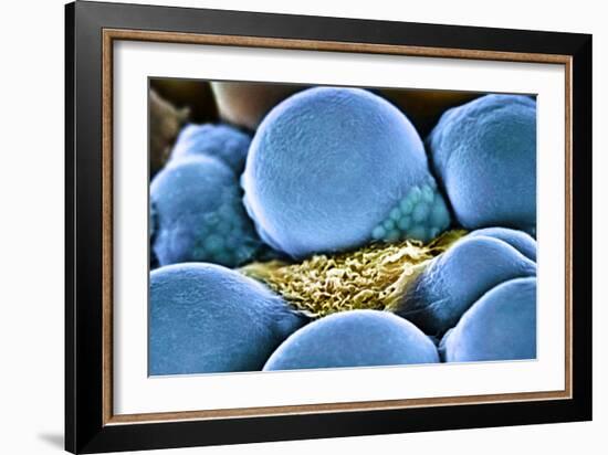 Fat Cells, SEM-Science Photo Library-Framed Photographic Print