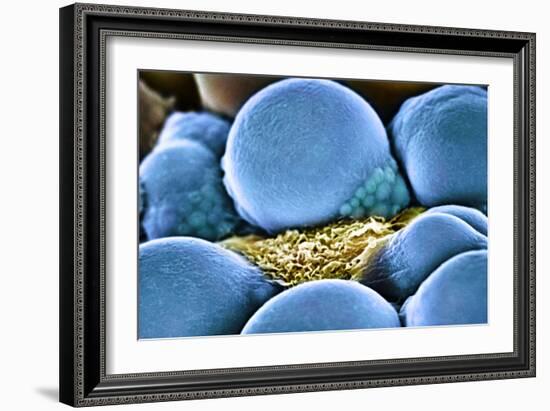 Fat Cells, SEM-Science Photo Library-Framed Photographic Print