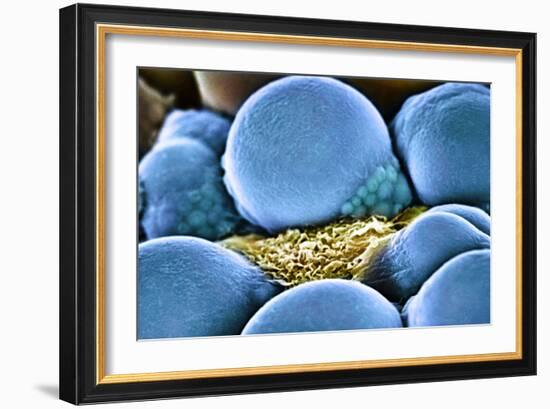 Fat Cells, SEM-Science Photo Library-Framed Photographic Print