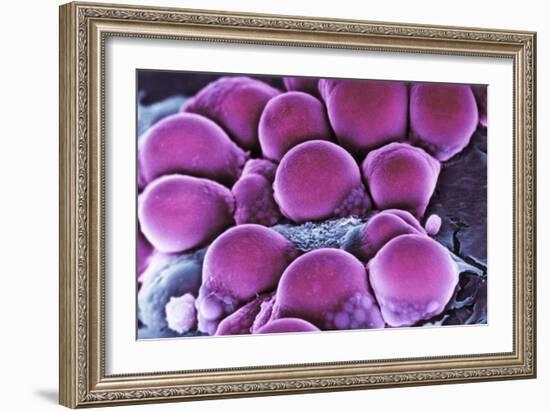 Fat Cells, SEM-Science Photo Library-Framed Photographic Print