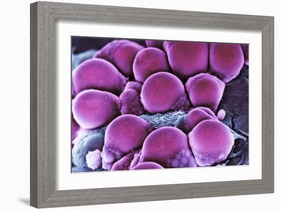 Fat Cells, SEM-Science Photo Library-Framed Photographic Print