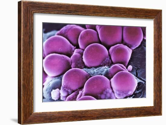 Fat Cells, SEM-Science Photo Library-Framed Photographic Print