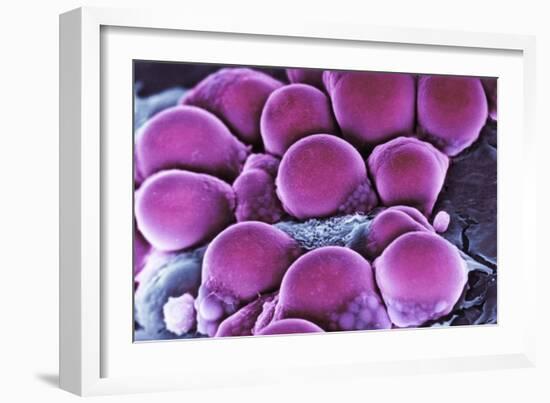 Fat Cells, SEM-Science Photo Library-Framed Photographic Print