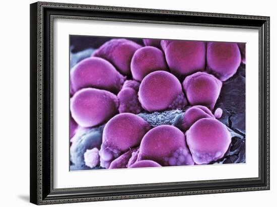 Fat Cells, SEM-Science Photo Library-Framed Photographic Print