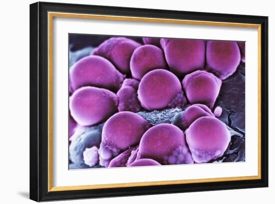 Fat Cells, SEM-Science Photo Library-Framed Photographic Print