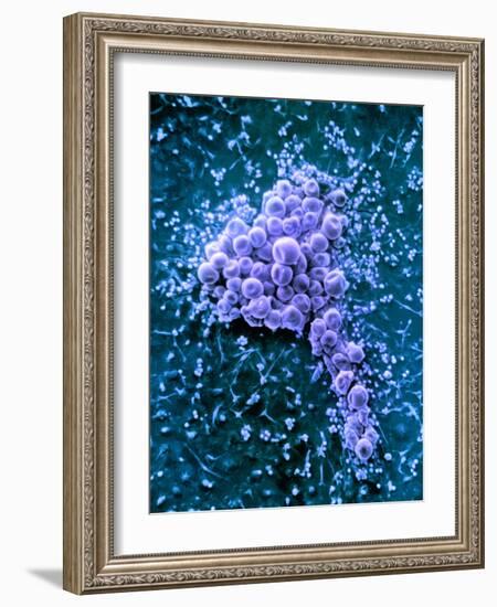 Fat Cells, SEM-Science Photo Library-Framed Photographic Print