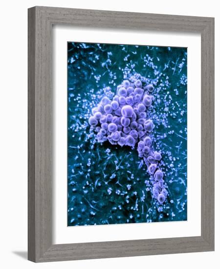 Fat Cells, SEM-Science Photo Library-Framed Photographic Print