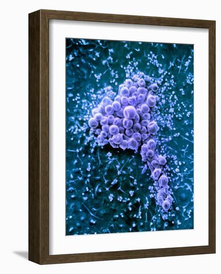 Fat Cells, SEM-Science Photo Library-Framed Photographic Print