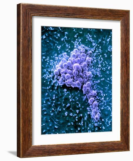 Fat Cells, SEM-Science Photo Library-Framed Photographic Print