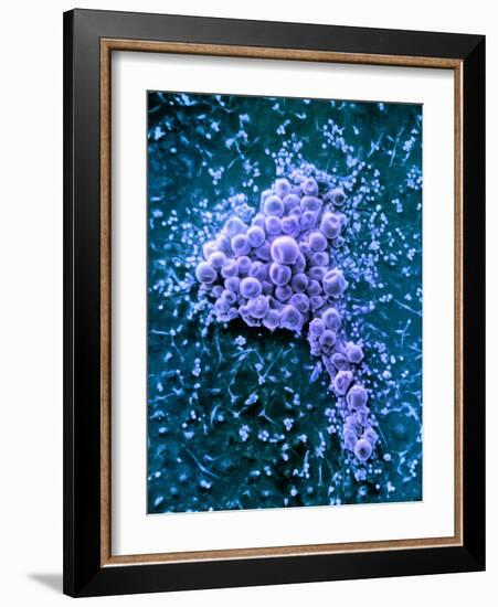 Fat Cells, SEM-Science Photo Library-Framed Photographic Print