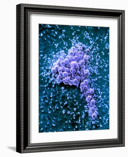 Fat Cells, SEM-Science Photo Library-Framed Photographic Print