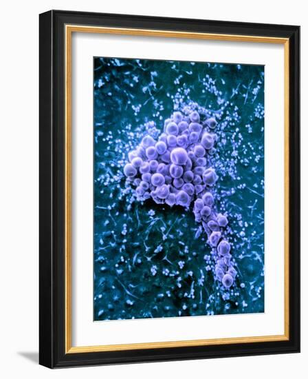 Fat Cells, SEM-Science Photo Library-Framed Photographic Print