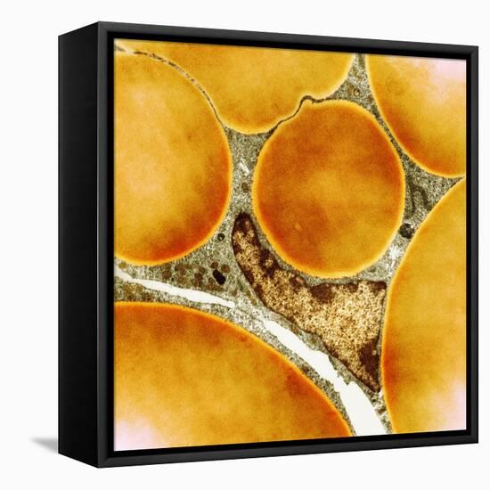 Fat Cells, TEM-Science Photo Library-Framed Premier Image Canvas