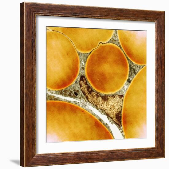 Fat Cells, TEM-Science Photo Library-Framed Premium Photographic Print