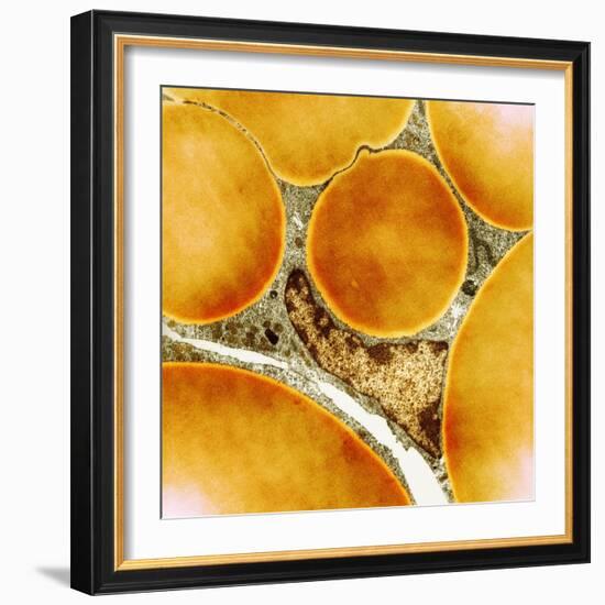 Fat Cells, TEM-Science Photo Library-Framed Premium Photographic Print