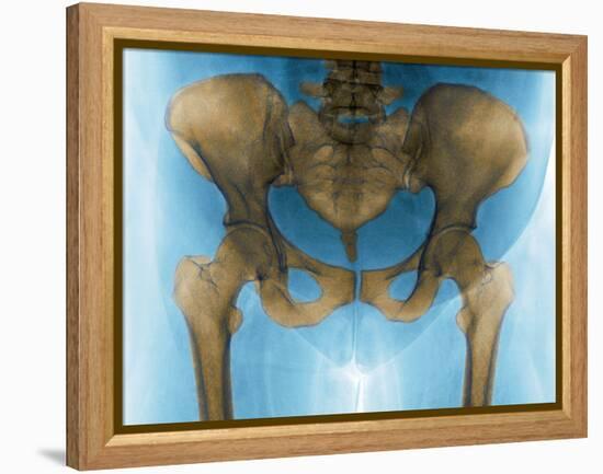 Female Pelvis, X-ray-Du Cane Medical-Framed Premier Image Canvas