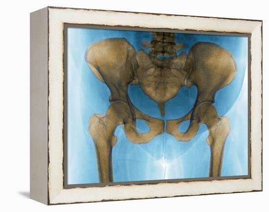 Female Pelvis, X-ray-Du Cane Medical-Framed Premier Image Canvas