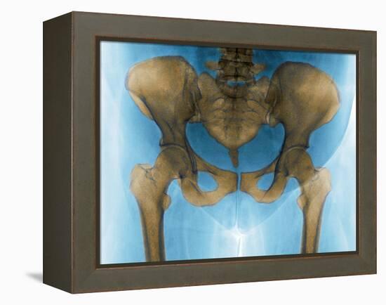 Female Pelvis, X-ray-Du Cane Medical-Framed Premier Image Canvas