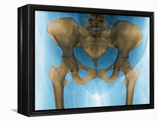 Female Pelvis, X-ray-Du Cane Medical-Framed Premier Image Canvas