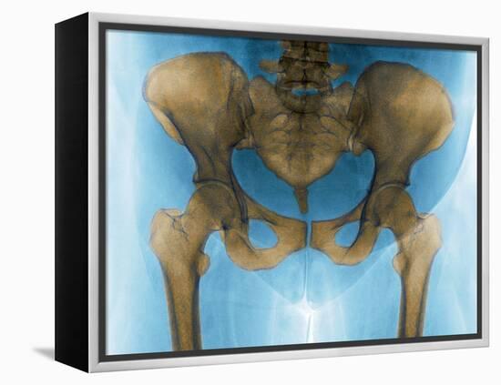 Female Pelvis, X-ray-Du Cane Medical-Framed Premier Image Canvas