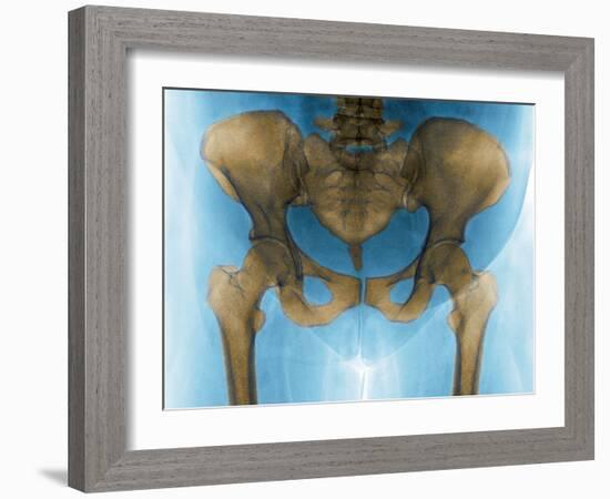 Female Pelvis, X-ray-Du Cane Medical-Framed Photographic Print