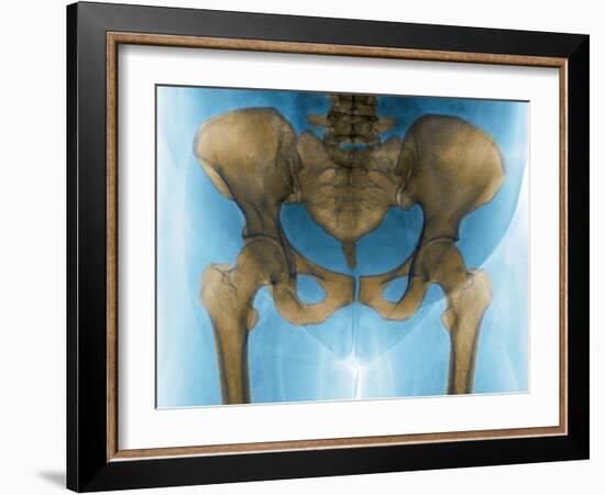 Female Pelvis, X-ray-Du Cane Medical-Framed Photographic Print