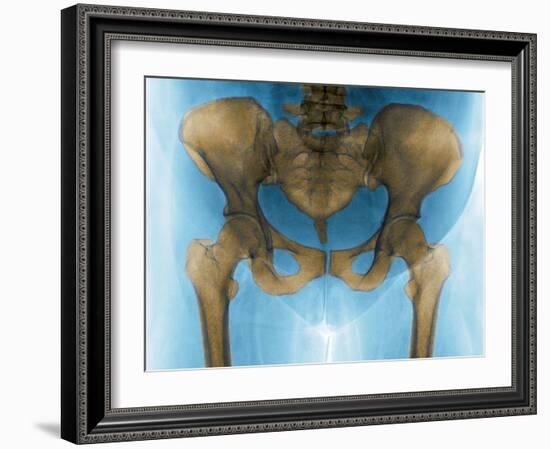 Female Pelvis, X-ray-Du Cane Medical-Framed Photographic Print