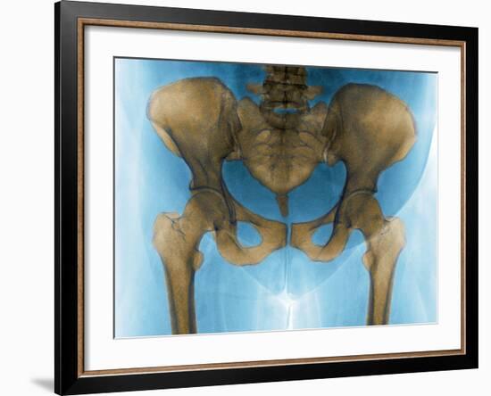 Female Pelvis, X-ray-Du Cane Medical-Framed Photographic Print