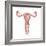 Female Reproductive Organs, Artwork-Henning Dalhoff-Framed Premium Photographic Print