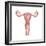 Female Reproductive Organs, Artwork-Henning Dalhoff-Framed Premium Photographic Print