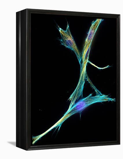 Fibroblast Cells, Fluorescent Micrograph-Dr. Torsten Wittmann-Framed Premier Image Canvas