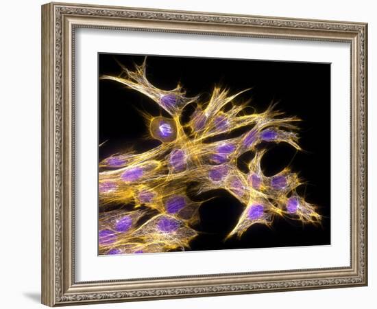 Fibroblast Cells, Fluorescent Micrograph-Dr. Torsten Wittmann-Framed Photographic Print