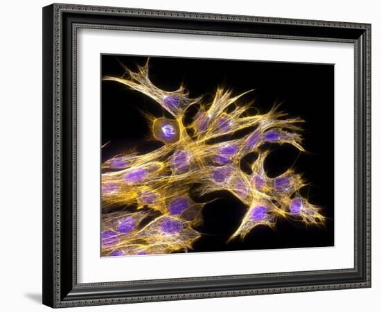 Fibroblast Cells, Fluorescent Micrograph-Dr. Torsten Wittmann-Framed Photographic Print