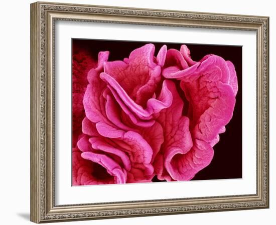 Fimbriae of a Fallopian Tube, SEM-Susumu Nishinaga-Framed Photographic Print