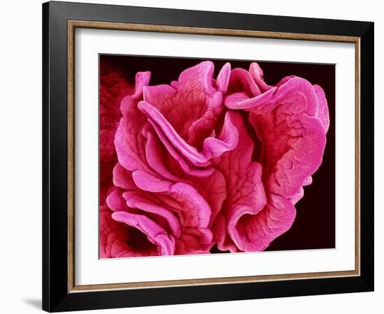 Fimbriae of a Fallopian Tube, SEM-Susumu Nishinaga-Framed Photographic Print