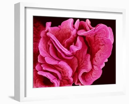 Fimbriae of a Fallopian Tube, SEM-Susumu Nishinaga-Framed Photographic Print