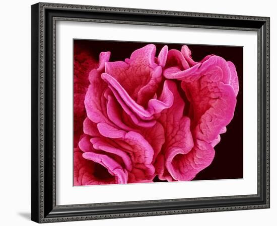 Fimbriae of a Fallopian Tube, SEM-Susumu Nishinaga-Framed Photographic Print