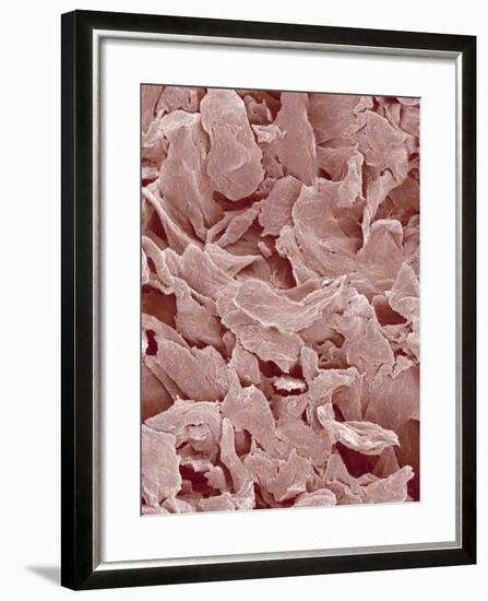 Fingernail-Micro Discovery-Framed Photographic Print