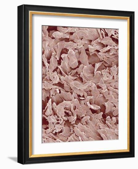 Fingernail-Micro Discovery-Framed Photographic Print