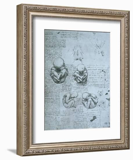 Five Views of a Foetus in the Womb, Facsimile Copy-Leonardo da Vinci-Framed Giclee Print